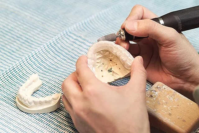 信頼できる歯科技工士による高品質の技工物